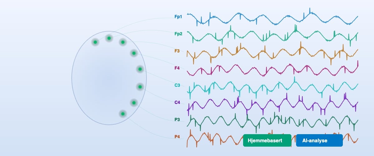 EEG hjernemonitorering med elektroder og signalanalyse
